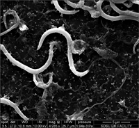 Standard electron microscopy image of Xenopus sperm.