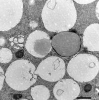 Electron microscope image of sheep oocyte vesicles and lipid droplets.